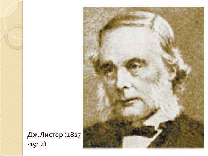 Дж. Листер (1827 -1912) 