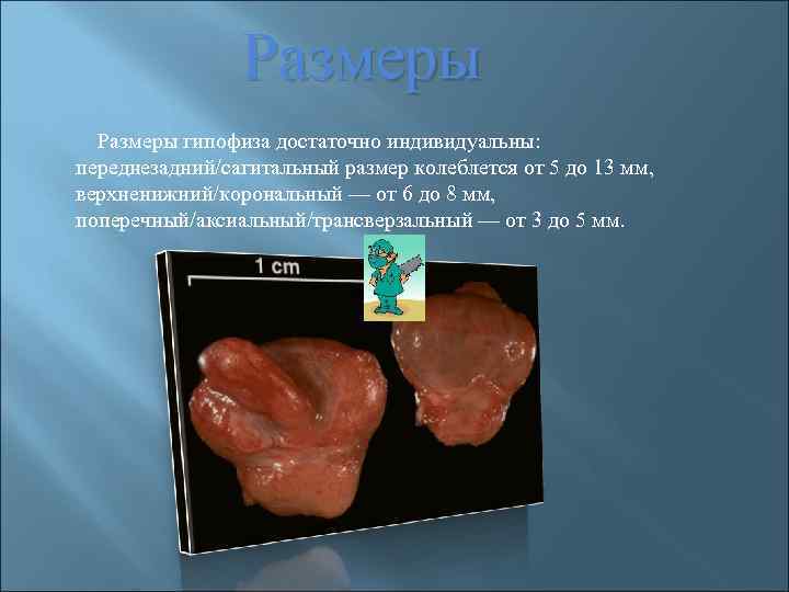 Размеры гипофиза достаточно индивидуальны: переднезадний/сагитальный размер колеблется от 5 до 13 мм, верхненижний/корональный —
