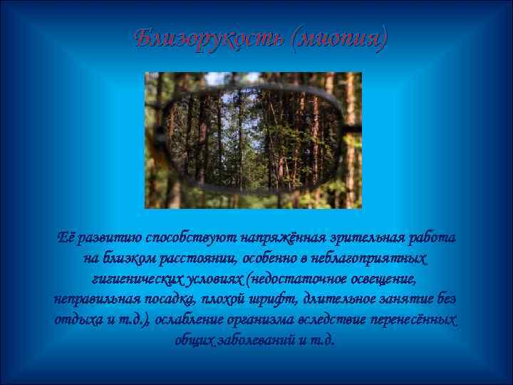 Близорукость (миопия) Её развитию способствуют напряжённая зрительная работа на близком расстоянии, особенно в неблагоприятных
