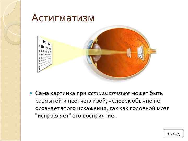 Астигматизм Сама картинка при астигматизме может быть размытой и неотчетливой, человек обычно не осознает