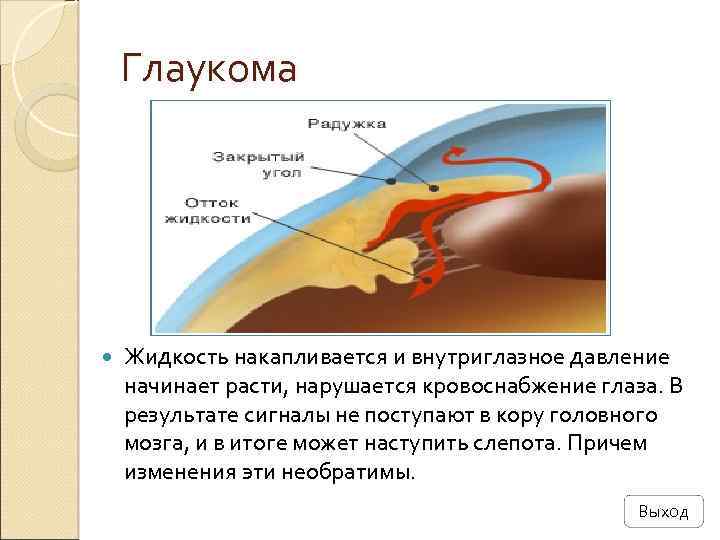 Схема оттока внутриглазной жидкости