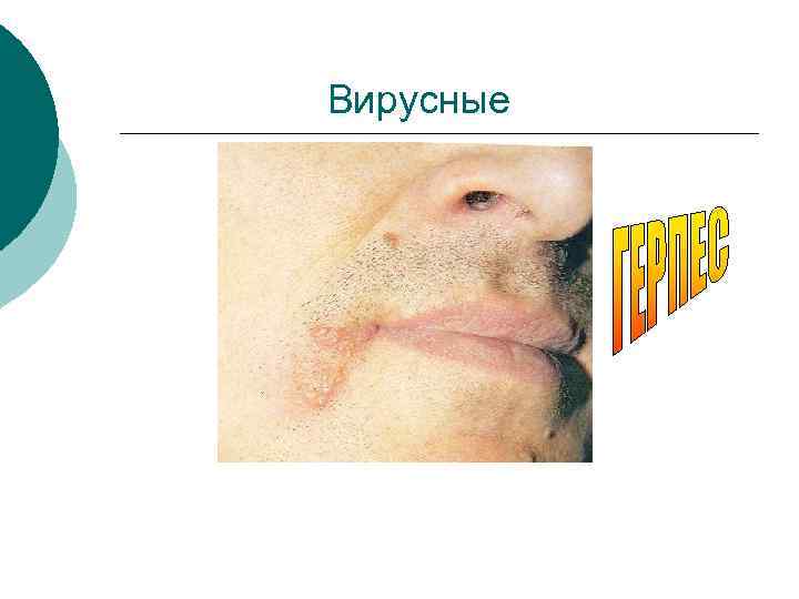 Вирусные 