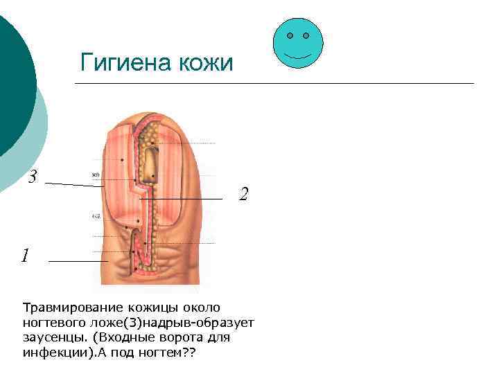 Гигиена кожи 3 2 1 Травмирование кожицы около ногтевого ложе(3)надрыв-образует заусенцы. (Входные ворота для