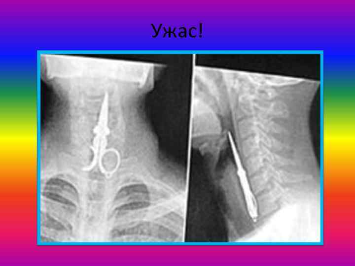 Ужас! 