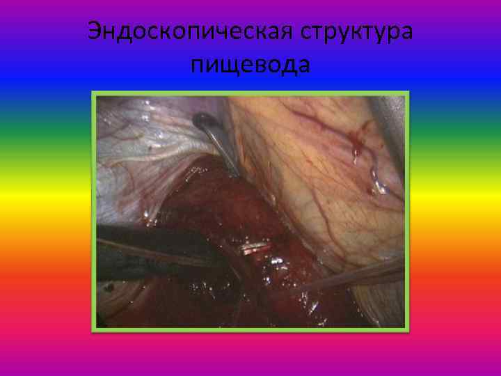 Эндоскопическая структура пищевода 