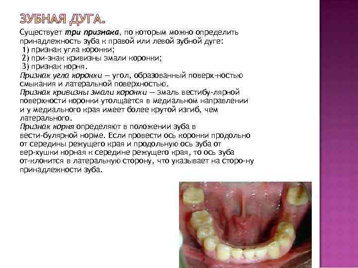 Существует три признака, по которым можно определить принадлежность зуба к правой или левой зубной