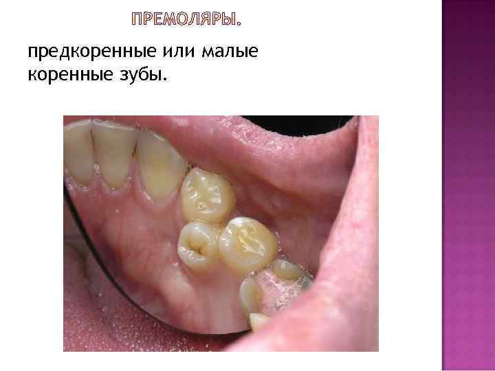 предкоренные или малые коренные зубы. 