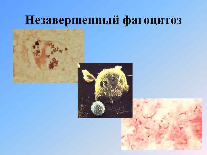 Незавершенный фагоцитоз 