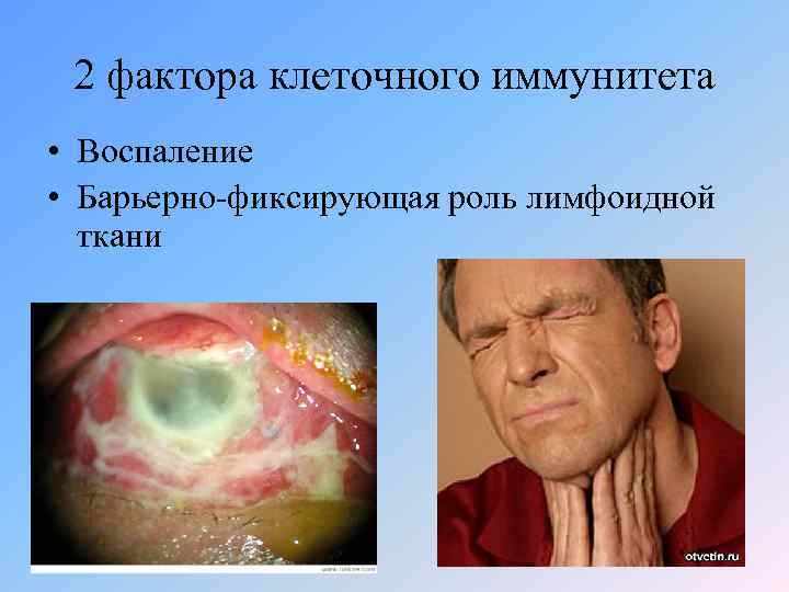 2 фактора клеточного иммунитета • Воспаление • Барьерно-фиксирующая роль лимфоидной ткани 