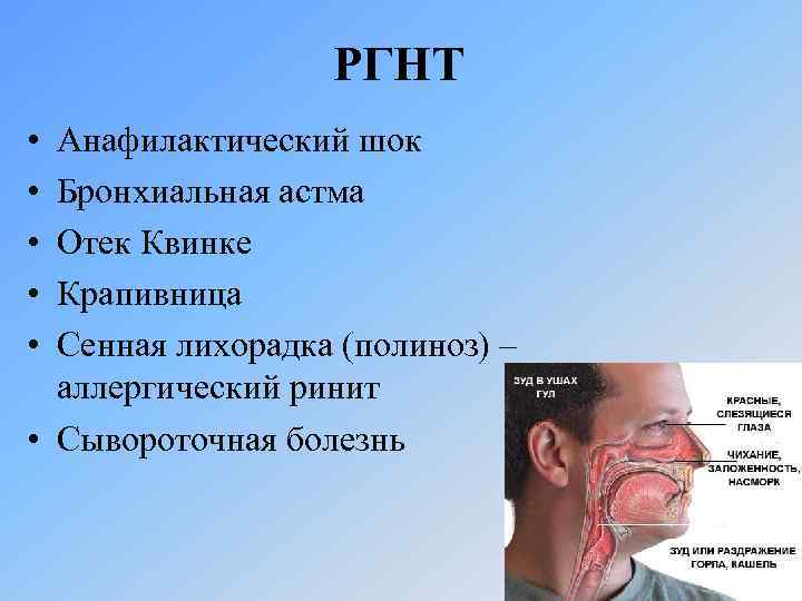 РГНТ • • • Анафилактический шок Бронхиальная астма Отек Квинке Крапивница Сенная лихорадка (полиноз)