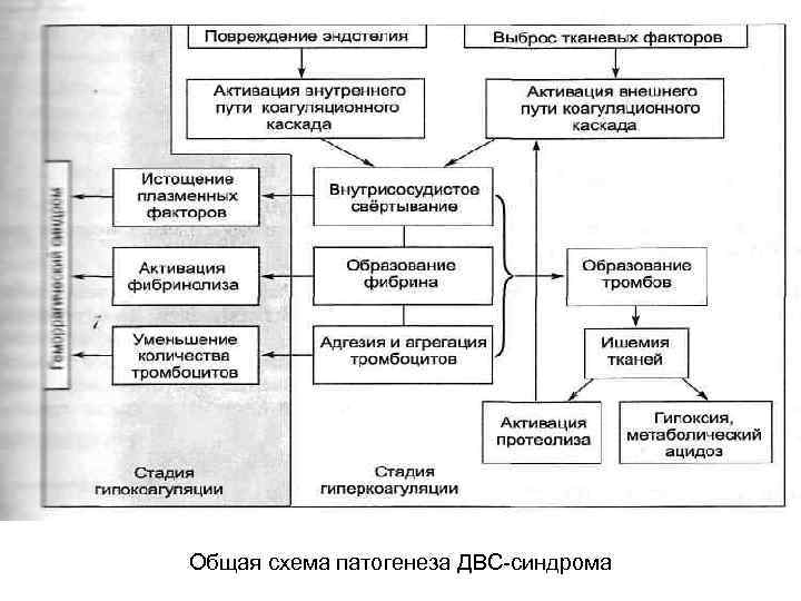 Общая схема патогенеза ДВС синдрома 