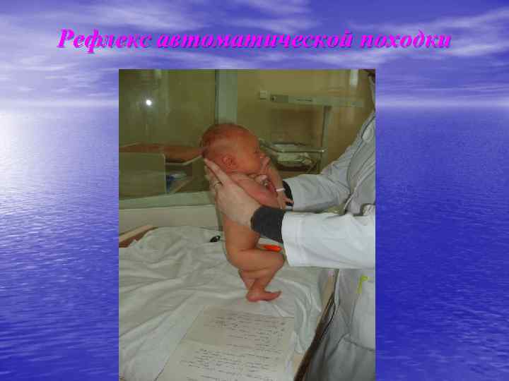 Рефлекс автоматической походки 