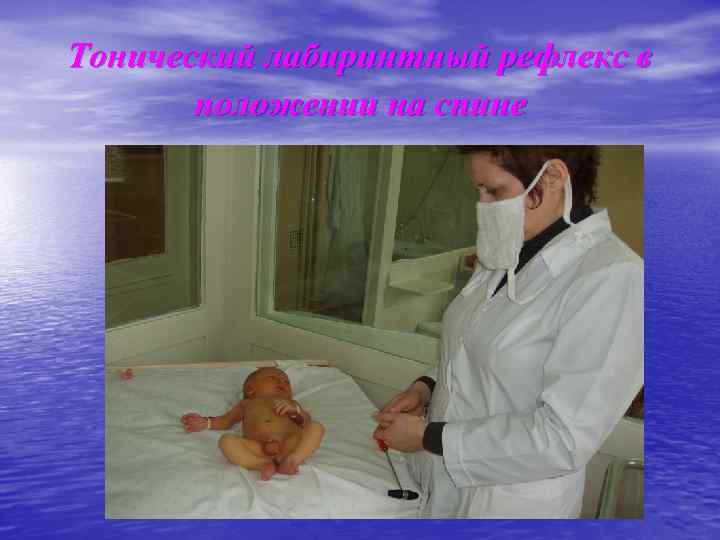 Тонический лабиринтный рефлекс в положении на спине 