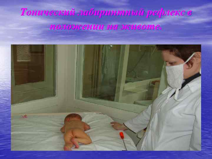 Тонический лабиринтный рефлекс в положении на животе. 