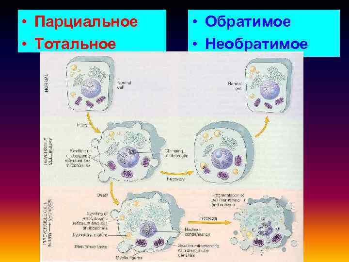  • Парциальное • Тотальное • Обратимое • Необратимое 