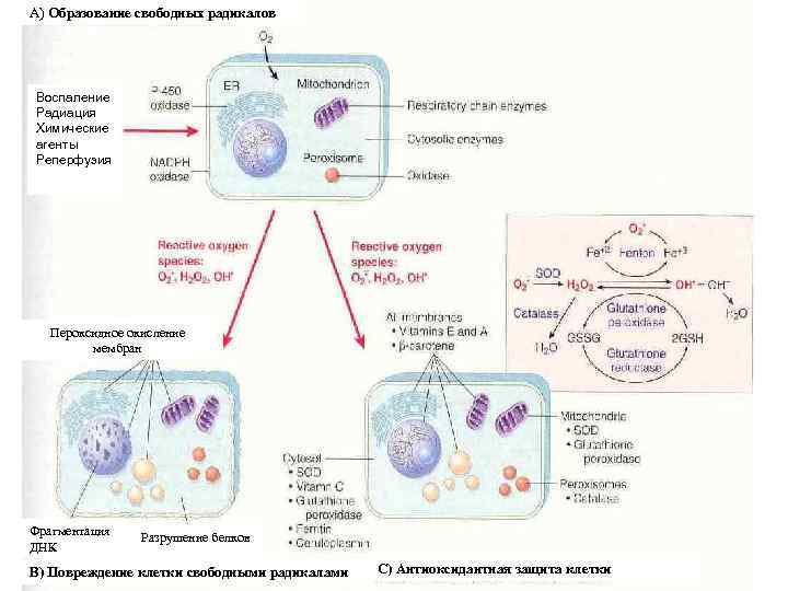 А) Образование свободных радикалов Воспаление Радиация Химические агенты Реперфузия Пероксидное окисление мембран Фрагментация ДНК