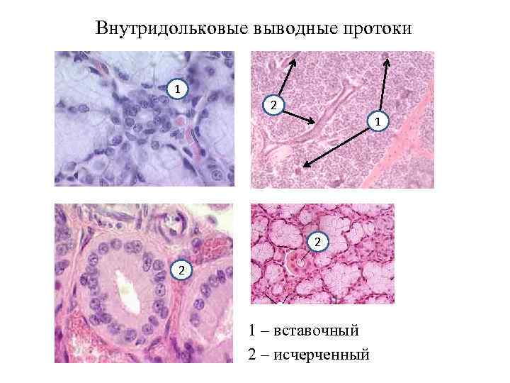 Пролиферация железистого эпителия на фоне воспаления