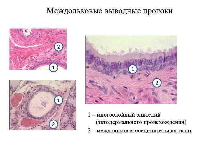 Междольковые выводные протоки 2 1 1 2 1 – многослойный эпителий (эктодермального происхождения) 2
