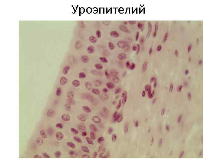 Уроэпителий 