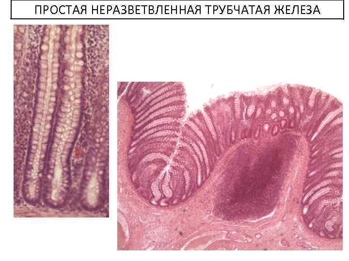 ПРОСТАЯ НЕРАЗВЕТВЛЕННАЯ ТРУБЧАТАЯ ЖЕЛЕЗА 