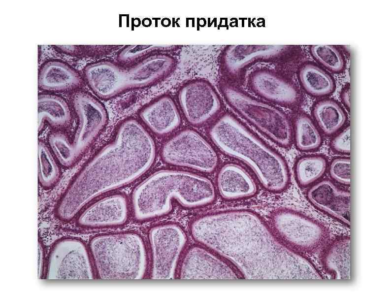 Проток придатка 