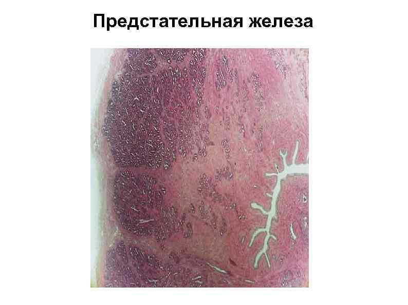 Предстательная железа 