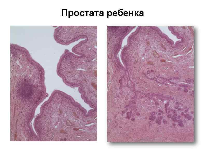 Простата ребенка 