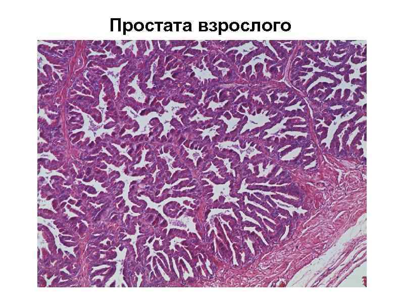 Простата взрослого 