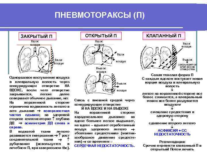 Клиническая картина открытого пневмоторакса