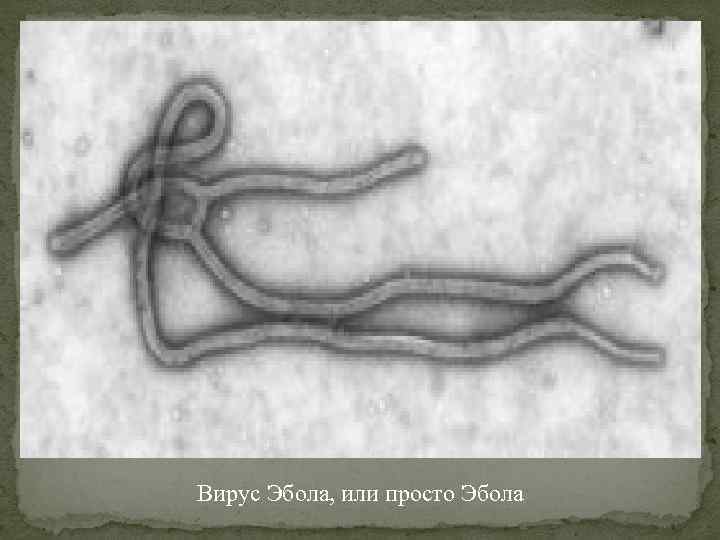 Вирус Эбола, или просто Эбола 