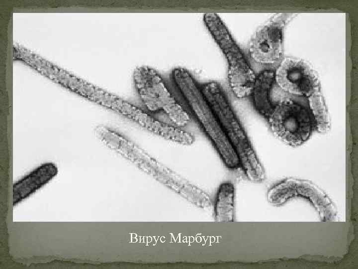 Вирус Марбург 