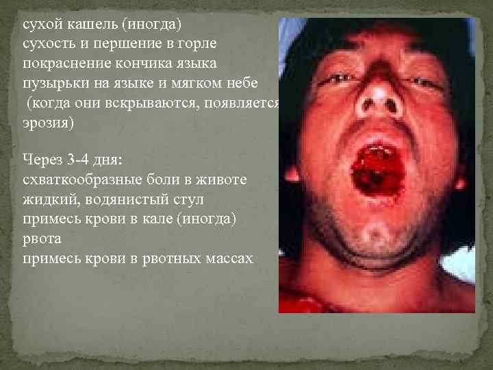 сухой кашель (иногда) сухость и першение в горле покраснение кончика языка пузырьки на языке