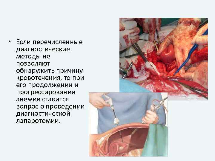  • Если перечисленные диагностические методы не позволяют обнаружить причину кровотечения, то при его