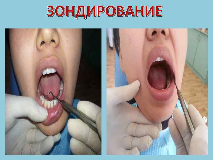  Функциональные методы исследования являются вспомогательными средствами диагностики. С их помощью выявляют ранние, скрытые