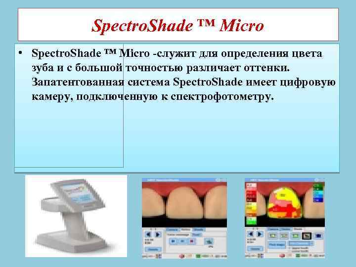  Периотест • Периотест С используется для определения степени подвижности зуба или имплантанта и