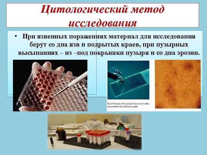 Серологический метод исследования • В первую очередь для проведения серологического анализа используют биологический материал,