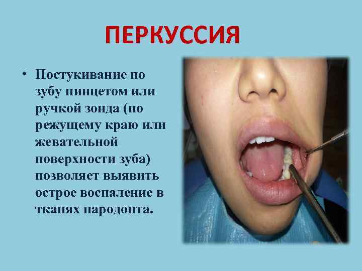 ЗОНДИРОВАНИЕ 