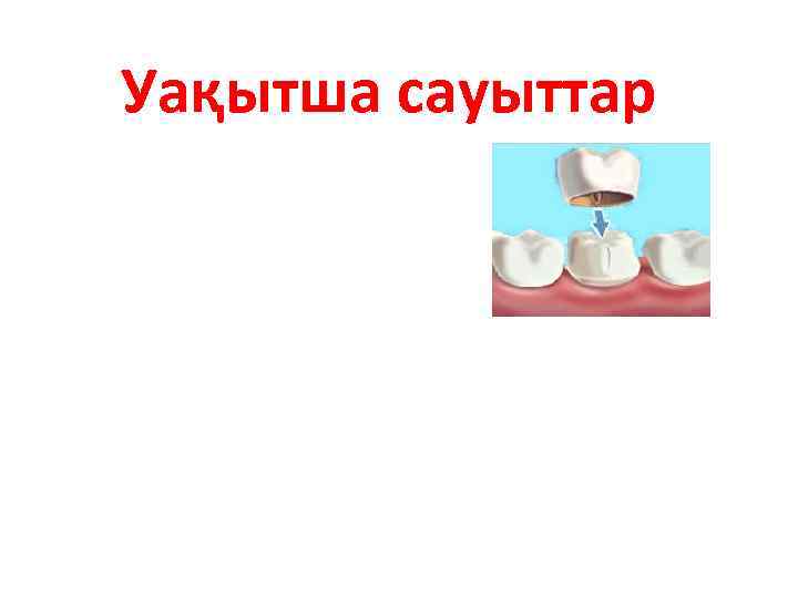 Уақытша сауыттар 