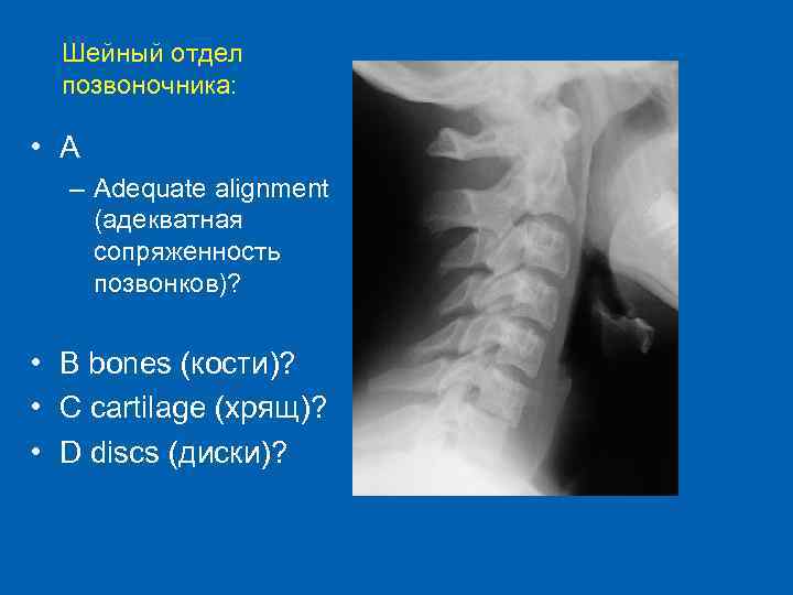 Шейный отдел позвоночника: • A – Adequate alignment (адекватная сопряженность позвонков)? • B bones