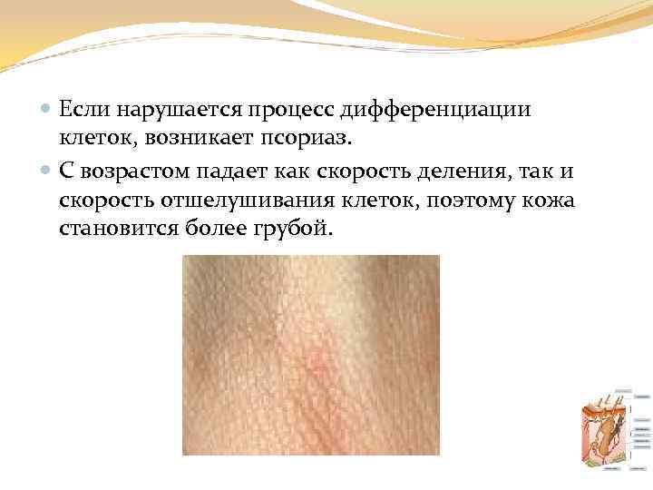  Если нарушается процесс дифференциации клеток, возникает псориаз. С возрастом падает как скорость деления,