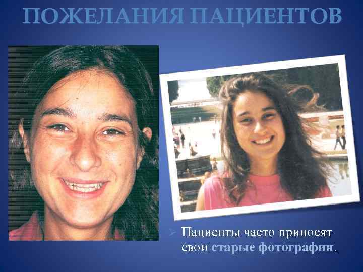 ПОЖЕЛАНИЯ ПАЦИЕНТОВ Ø Пациенты часто приносят свои старые фотографии. 