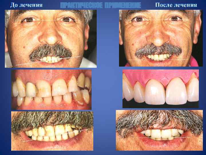 До лечения ПРАКТИЧЕСКОЕ ПРИМЕНЕНИЕ После лечения 