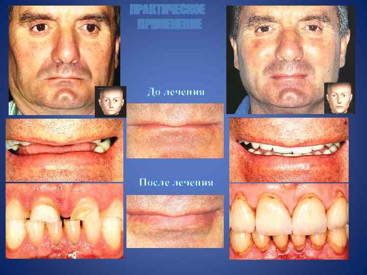 ПРАКТИЧЕСКОЕ ПРИМЕНЕНИЕ До лечения После лечения 