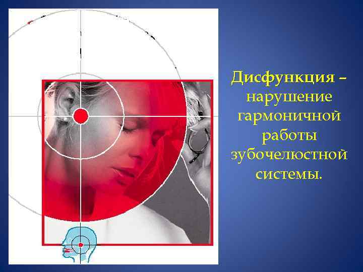 Дисфункция – нарушение гармоничной работы зубочелюстной системы. 