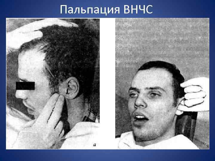 Пальпация ВНЧС 