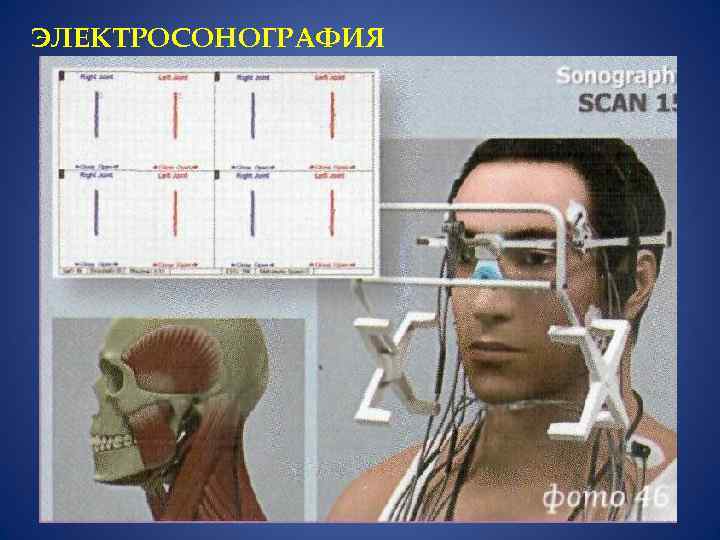 ЭЛЕКТРОСОНОГРАФИЯ 