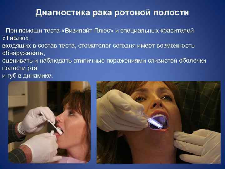Диагностика рака ротовой полости При помощи теста «Визилайт Плюс» и специальных красителей «Ти. Блю»