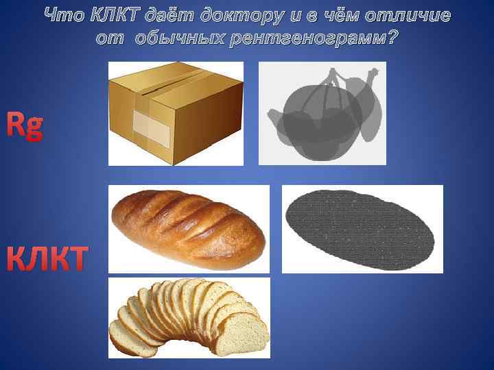 Что КЛКТ даёт доктору и в чём отличие от обычных рентгенограмм? Rg КЛКТ 