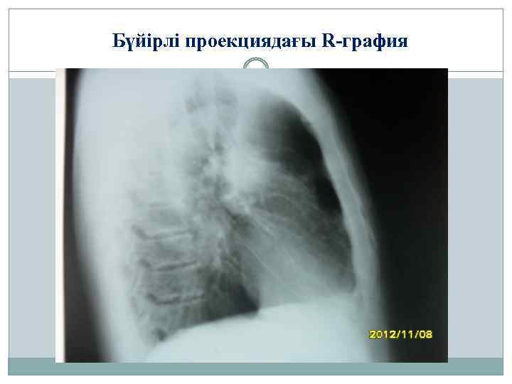 Бүйірлі проекциядағы R-графия 