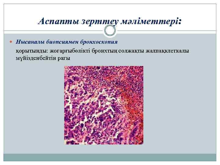 Аспапты зерттеу мәліметтері: Нысаналы биопсиямен бронхоскопия қорытынды: жоғарғыбөлікті бронхтың солжақты жалпақклеткалы мүйізденбейтін рагы 